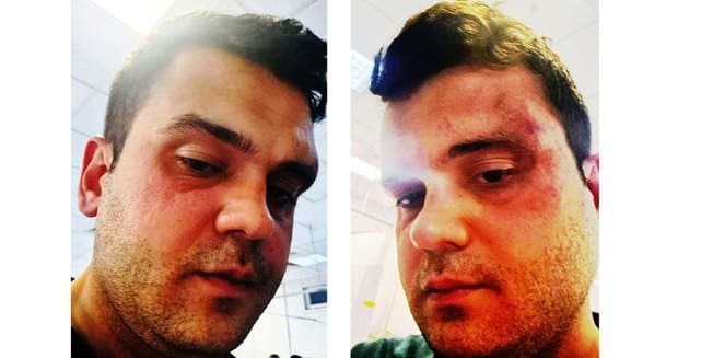 Malatya'da Avukata Çocuğu Önünde Sopalı Tuzak
